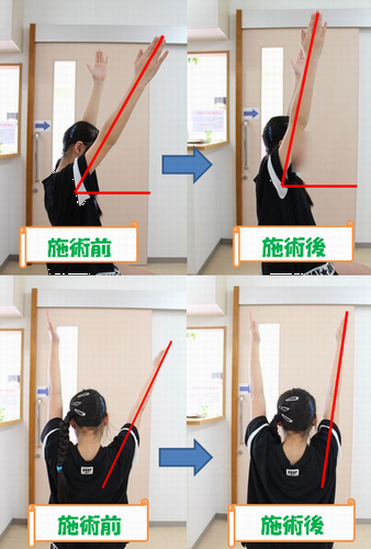 ビフォーアフター.png
