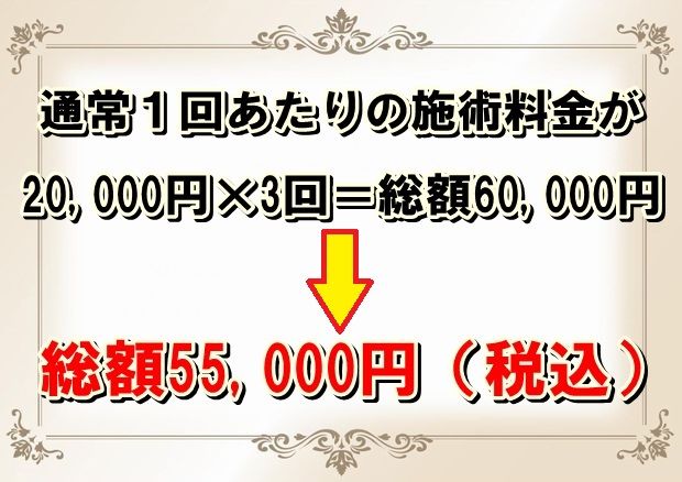 小顔矯正新料金.jpg